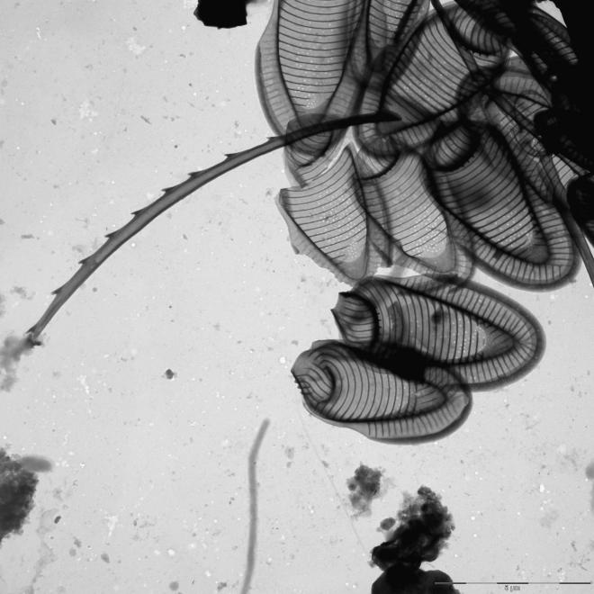 Mallomonas denticulata | Silica-scaled chrysophytes of Europe